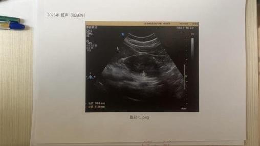 北京市卫健委答复女律师体检争议:未发现体检造假