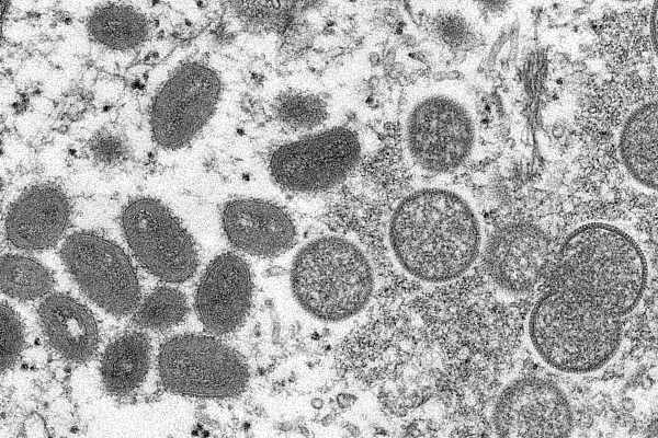 猴痘病毒显微镜图像 （资料图）