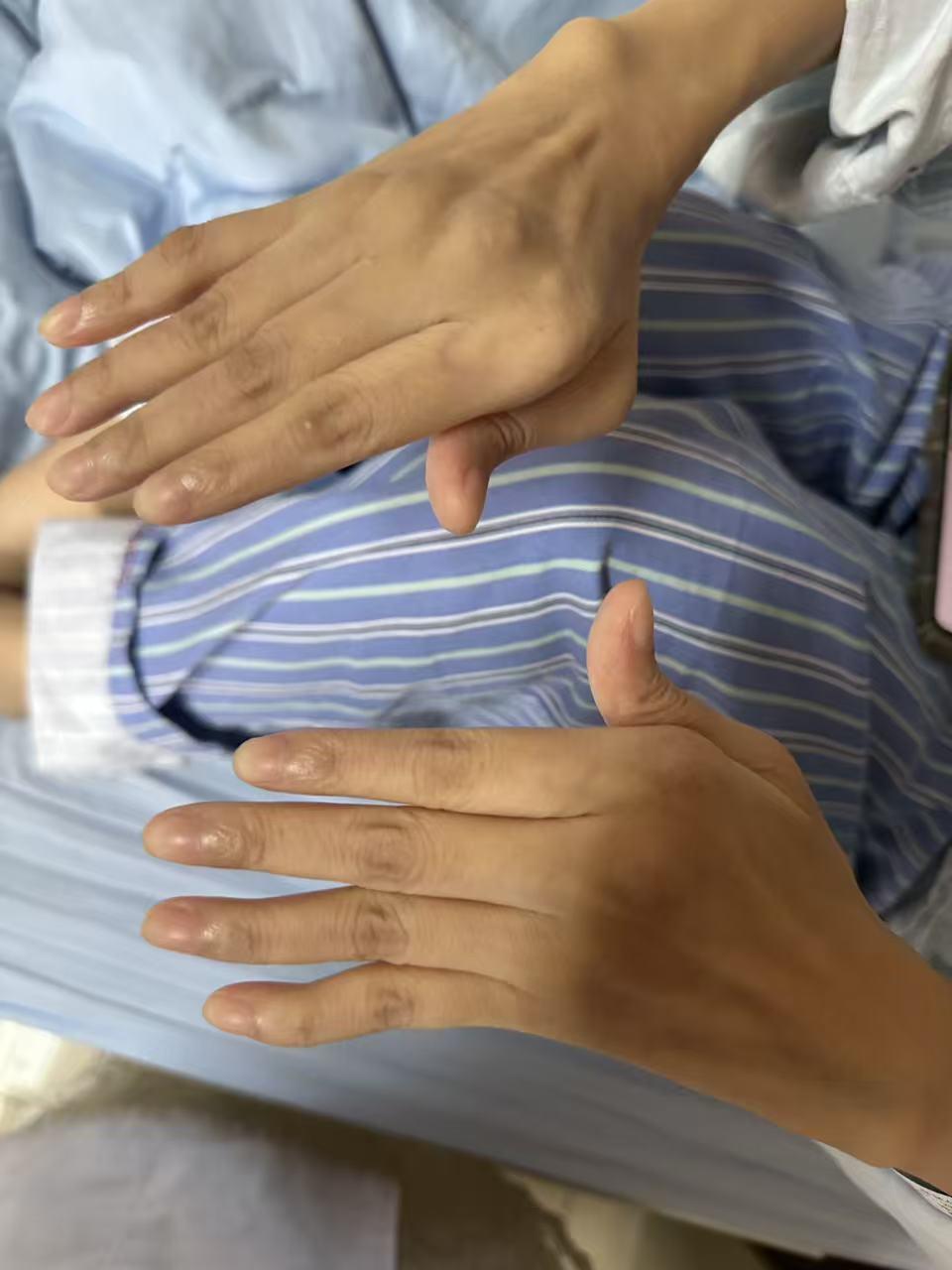 万万没想到，听力下降，竟是因为这个病